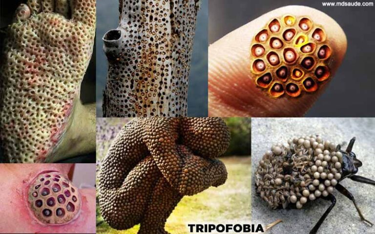 Trypophobia: what it is, main symptoms, and treatment. - SYP STUDIOS