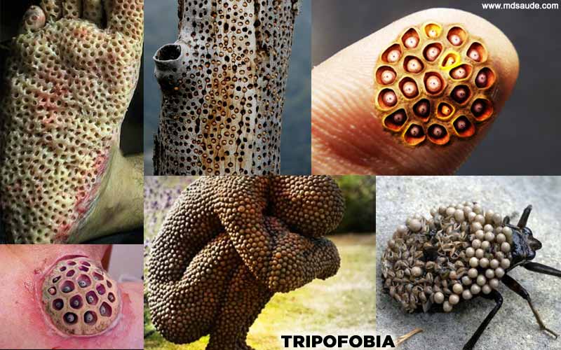 Trypophobia meaning