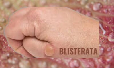 Blisterata: Everything You Need to Know